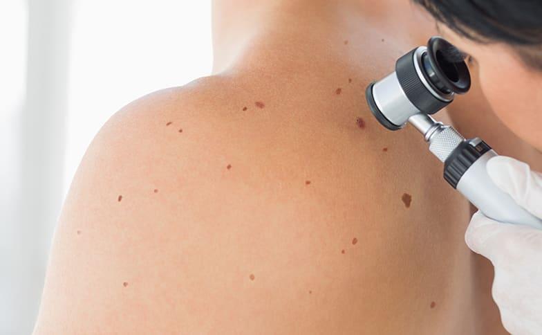 Dermatologist performing skin cancer screening at Montgomery Medical Clinic in Gaithersburg MD